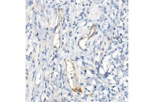 Immunohistochemistry (IHC) image for anti-Nitric Oxide Synthase 3 (Endothelial Cell) (NOS3) antibody (ABIN7268920)