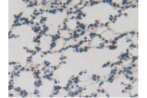 IHC-P analysis of Rat Lung Tissue, with DAB staining. (SFTPB antibody  (AA 111-329))