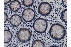 Immunohistochemical staining of paraffin-embedded Human Kidney tissue using anti-CRYM mouse monoclonal antibody. (CRYM antibody)