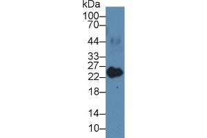 Detection of MYL3 in Porcine Heart lysate using Polyclonal Antibody to Myosin Light Chain 3, Alkali, Ventricular, Slow Skeletal (MYL3)
