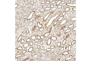 IHC analysis of SGCE using anti-SGCE antibody (ABIN7601544). (SGCE antibody  (AA 38-407))