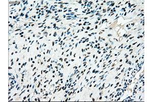 Immunohistochemical staining of paraffin-embedded colon tissue using anti-MAP2K4mouse monoclonal antibody. (MAP2K4 antibody)