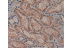 Used in DAB staining on fromalin fixed paraffin- embedded Kidney tissue (GFRA2 antibody  (AA 117-314))