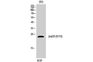 Western Blotting (WB) image for anti-Cyclin-Dependent Kinase 5, Regulatory Subunit 1 (p35) (CDK5R1) (pSer113) antibody (ABIN3179659) (CDK5R1 antibody  (pSer113))