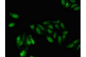 Immunofluorescent analysis of Hela cells using ABIN7153414 at dilution of 1:100 and Alexa Fluor 488-congugated AffiniPure Goat Anti-Rabbit IgG(H+L) (GABPB2 antibody  (AA 163-440))