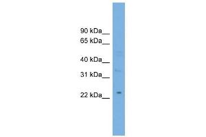 MBL2 antibody used at 1 ug/ml to detect target protein.