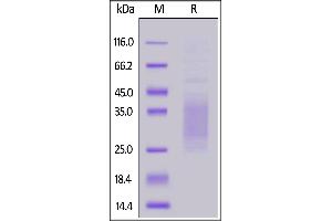 Mouse TREM2, His, Tag on  under reducing (R) condition. (TREM2 Protein (AA 19-171) (His tag))