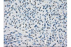 Immunohistochemical staining of paraffin-embedded endometrium tissue using anti-PORmouse monoclonal antibody. (POR antibody)