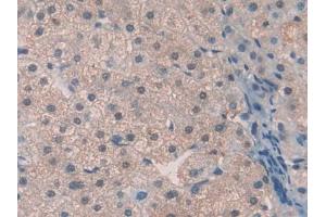 DAB staining on IHC-P; Samples: Human Liver Tissue (Thrombopoietin antibody  (AA 22-349))