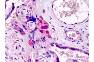 Human Placenta: Formalin-Fixed, Paraffin-Embedded (FFPE) (GATA3 antibody  (N-Term))