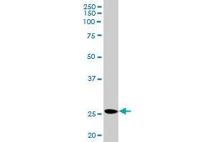 PRL MaxPab rabbit polyclonal antibody. (Prolactin antibody  (AA 1-227))