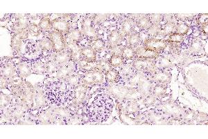 Paraformaldehyde-fixed, paraffin embedded Rat kidney, Antigen retrieval by boiling in sodium citrate buffer (pH6. (Kininogen-1 Light Chain antibody)