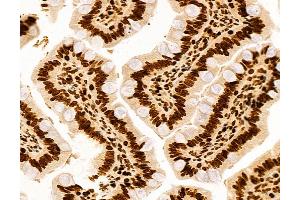ABIN6260553 and ABIN6272990 at 1/100 staining Rat colon tissue by IHC-P. (CCDC115 antibody  (Internal Region))