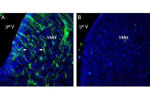 Expression of GPR139 in rat ventromedial hypothalamus (VMH).