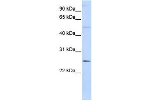 WB Suggested Anti-FTHL17 Antibody Titration:  0. (FTHL17 antibody  (N-Term))