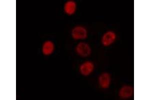ABIN6274346 staining HuvEc cells by IF/ICC. (TRA2A antibody  (C-Term))