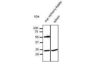 Anti-Rab8 Ab at 1/500 dilution, Iysates at 50 per Iane, rabbit polyclonal to Goat IgG (HRP) at 1/10,000 dilution, (RAB8A antibody  (C-Term))