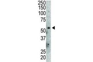 Western Blotting (WB) image for anti-Mdm2, p53 E3 Ubiquitin Protein Ligase Homolog (Mouse) (MDM2) (AA 393-424) antibody (ABIN3031739)