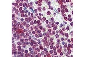 Immunohistochemistry (IHC) image for anti-Cell Division Cycle 25 Homolog A (S. Pombe) (CDC25A) (AA 271-300) antibody (ABIN3030442)