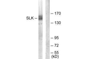 Western blot analysis of extracts from COLO205 cells, using SLK antibody.