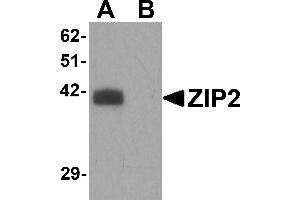 Western Blotting (WB) image for anti-Solute Carrier Family 39 (Zinc Transporter), Member 2 (Slc39a2) (N-Term) antibody (ABIN1031682) (ZIP2 antibody  (N-Term))
