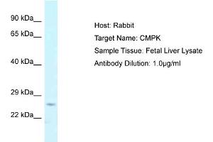 Host: Rabbit Target Name: CMPK Sample Tissue: Human Fetal Liver Antibody Dilution: 1ug/ml (Cytidine Monophosphate (UMP-CMP) Kinase 1, Cytosolic (CMPK1) (N-Term) antibody)