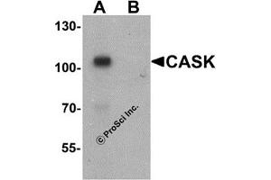 Western Blotting (WB) image for anti-Calcium/calmodulin-Dependent serine Protein Kinase (MAGUK Family) (CASK) (N-Term) antibody (ABIN1031293) (CASK antibody  (N-Term))