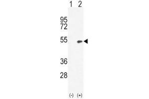 Western blot analysis of BMP4 antibody and 293 cell lysate (2 ug/lane) either nontransfected (Lane 1) or transiently transfected (2) with the BMP4 gene. (BMP4 antibody  (AA 5-34))