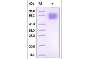 SDS-PAGE (SDS) image for Interleukin 18 Binding Protein (IL18BP) (AA 31-194) protein (Fc Tag) (ABIN2181350)