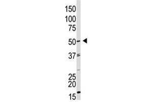 Image no. 1 for anti-Growth Differentiation Factor 9 (GDF9) (AA 37-67), (N-Term) antibody (ABIN357463) (GDF9 antibody  (N-Term))