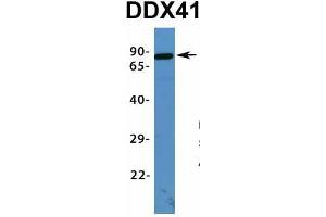 Host:  Rabbit  Target Name:  DDX41  Sample Type:  Human Fetal Lung  Antibody Dilution:  1. (DDX41 antibody  (N-Term))