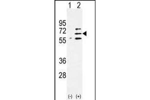 Western blot analysis of Parp6 (arrow) using rabbit polyclonal Parp6 Antibody (C-term) (ABIN390248 and ABIN2840713). (PARP6 antibody  (C-Term))