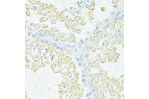 Immunohistochemistry (Paraffin-embedded Sections) (IHC (p)) image for anti-Myosin, Heavy Polypeptide 10, Non-Muscle (MYH10) (AA 1908-2007) antibody (ABIN6144232)