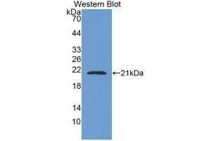 Detection of Recombinant CAP2, Human using Monoclonal Antibody to Adenylyl Cyclase Associated Protein 2 (CAP2) (CAP2 antibody  (AA 317-455))