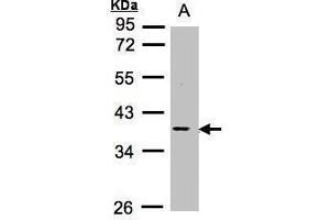 WB Image Sample (30μg whole cell lysate) A:Raji , 10% SDS PAGE antibody diluted at 1:1000