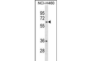 MDH1B Antibody (Center) (ABIN1538277 and ABIN2849269) western blot analysis in NCI- cell line lysates (35 μg/lane). (MDH1B antibody  (AA 304-332))