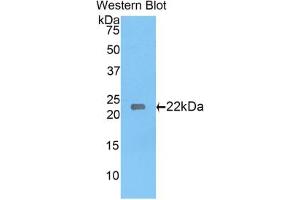 Western blot analysis of the recombinant protein. (Laminin gamma 1 antibody  (AA 1228-1404))
