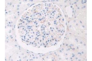 Used in DAB staining on fromalin fixed paraffin- embedded kidney tissue (HPR antibody  (AA 30-85))