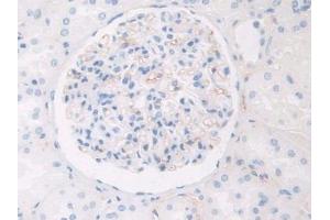 Used in DAB staining on fromalin fixed paraffin- embedded kidney tissue (HPR antibody  (AA 30-85))