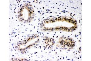 IHC analysis of RUNX2 using anti-RUNX2 antibody (ABIN3043318).
