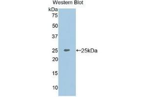 Detection of Recombinant MEPE, Rat using Polyclonal Antibody to Matrix Extracellular Phosphoglycoprotein (MEPE) (MEPE antibody  (AA 28-224))