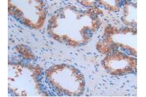 IHC-P analysis of Human Prostate Gland Tissue, with DAB staining. (CRP antibody  (AA 17-224))