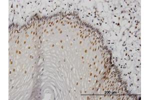 Image no. 3 for anti-Metastasis Associated 1 (MTA1) (AA 601-701) antibody (ABIN598597) (MTA1 antibody  (AA 601-701))