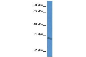 WB Suggested Anti-2610034B18Rik Antibody Titration: 1. (ARPIN antibody  (N-Term))