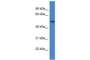 WB Suggested Anti-ARHGAP19 AntibodyTitration: 1. (ARHGAP19 antibody  (C-Term))
