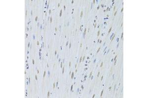 Immunohistochemistry (Paraffin-embedded Sections) (IHC (p)) image for anti-Heterogeneous Nuclear Ribonucleoprotein K (HNRNPK) (AA 1-280) antibody (ABIN3022414)