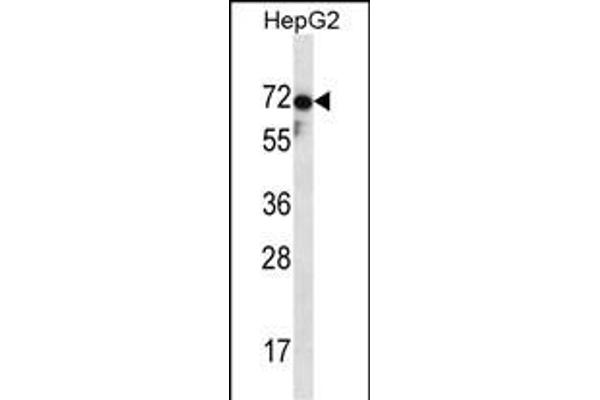ZP1 antibody  (C-Term)