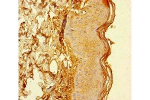 Immunohistochemistry of paraffin-embedded human skin tissue using ABIN7147268 at dilution of 1:100 (CYREN (AA 1-157) antibody)