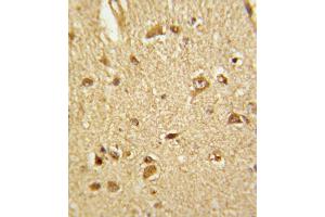 Immunohistochemistry (IHC) image for anti-Cystathionine-beta-Synthase (CBS) antibody (ABIN3002904) (CBS antibody)