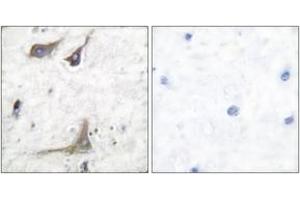 Immunohistochemistry analysis of paraffin-embedded human brain tissue, using Cox1 Antibody. (COX1 antibody  (AA 550-599))